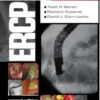 ERCP: Expert Consult – Online and Print, 2e