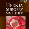 Hernia Surgery Simplified