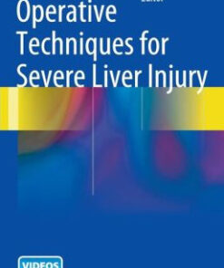 Operative Techniques for Severe Liver Injury