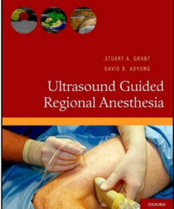 Ultrasound Guided Regional Anesthesia