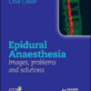 Epidural Anaesthesia: Images, Problems and Solutions