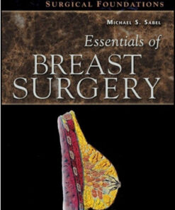 Essentials of Breast Surgery: A Volume in the Surgical Foundations Series