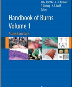 Handbook of Burns Volume 1: Acute Burn Care