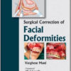 Surgical Correction of Facial Deformities