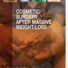 Cosmetic Surgery After Massive Weight Loss