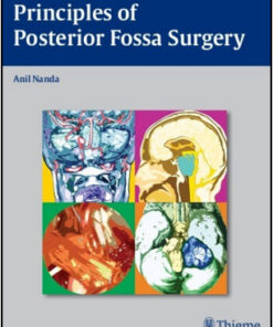 Principles of Posterior Fossa Surgery