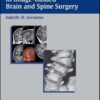 Advanced Techniques in Image-Guided Brain and Spine Surgery