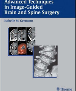 Advanced Techniques in Image-Guided Brain and Spine Surgery