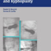 Vertebroplasty and Kyphoplasty