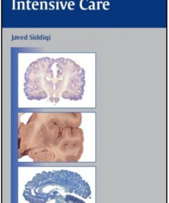 Neurosurgical Intensive Care