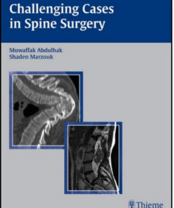 Challenging Cases in Spine Surgery