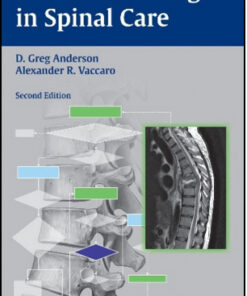 Decision Making in Spinal Care