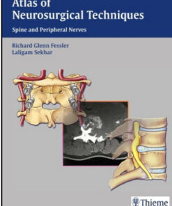 Atlas of Neurosurgical Techniques: Spine and Peripheral Nerves