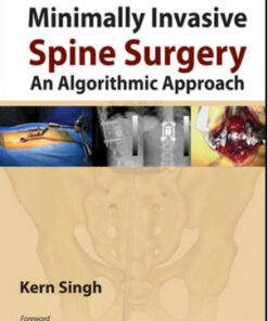 Minimally Invasive Spine Surgery: An Algorithmic Approach