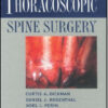 Thoracoscopic Spine Surgery