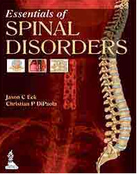 Essentials of Spinal Disorders 1st Edition