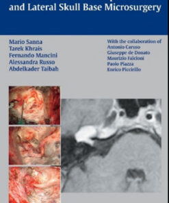 The Facial Nerve in Temporal Bone and Lateral Skull Base Microsurgery