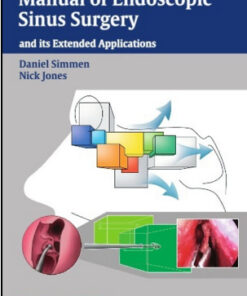 Manual of Endoscopic Sinus Surgery and its Extended Applications