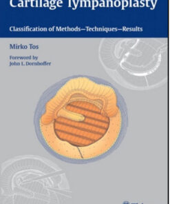 Cartilage Tympanoplasty: Classification of Methods — Techniques — Results