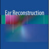 Ear Reconstruction