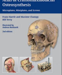 Atlas of Craniomaxillofacial Osteosynthesis: Microplates, Miniplates, and Screws, 2nd Edition