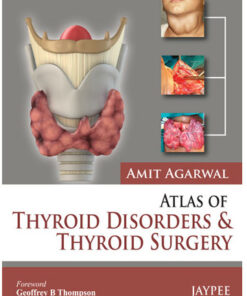 Atlas of Thyroid Disorders and Thyroid Surgery