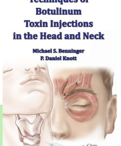 Techniques of Botulinum Toxin