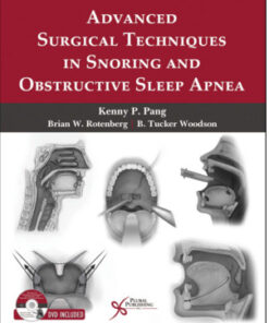 Advanced Surgical Techniques in Snoring and Obstructive Sleep Apnea