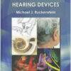 Cochlear Implants and Other Implantable Hearing Devices