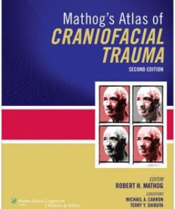 Mathog’s Atlas of Craniofacial Trauma