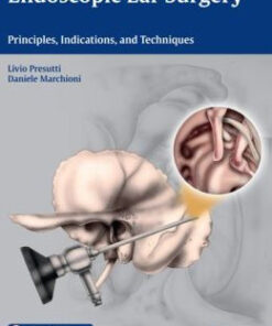 Endoscopic Ear Surgery: Principles, Indications, and Techniques