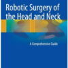 Robotic Surgery of the Head and Neck: A Comprehensive Guide