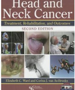 Head and Neck Cancer: Treatment, Rehabilitation, and Outcomes