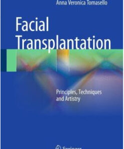 Face Transplantation: Principles, Techniques and Artistry