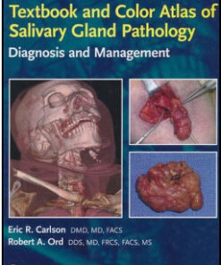 Textbook and Color Atlas of Salivary Gland Pathology: Diagnosis and Management 1st Edition