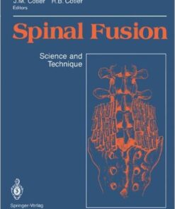 Spinal Fusion: Science and Technique