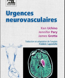 Urgences neurovasculaires