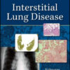 Interstitial Lung Disease, 5th Edition