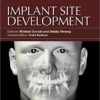 Implant Site Development 1st Edition