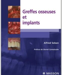 Greffes osseuses et implants