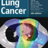 Lung Cancer, 4th Edition