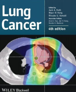 Lung Cancer, 4th Edition