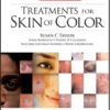 Treatments for Skin of Color