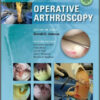 Operative Arthroscopy, 4th Edition