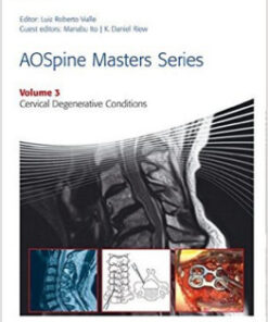 AOSpine Masters Series Volume 3: Cervical Degenerative Conditions 1st Edition