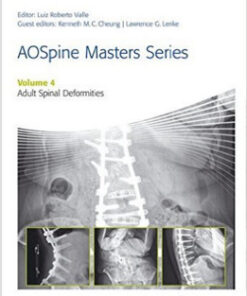 AOSpine Masters Series, Volume 4: Adult Spinal Deformities 1st Edition