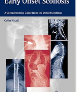 Early Onset Scoliosis: A Comprehensive Guide from the Oxford Meetings 1st edition Edition