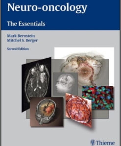 Neuro-oncology: The Essentials