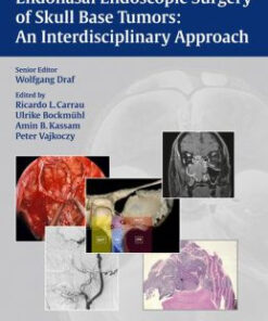 Endonasal Endoscopic Surgery of Skull Base Tumors: An Interdisciplinary Approach