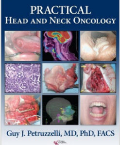 Practical Head and Neck Oncology